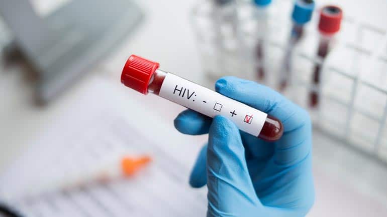 HIV-Testwochen: Kostenlose Tests und Beratung im Gesundheitsreferat