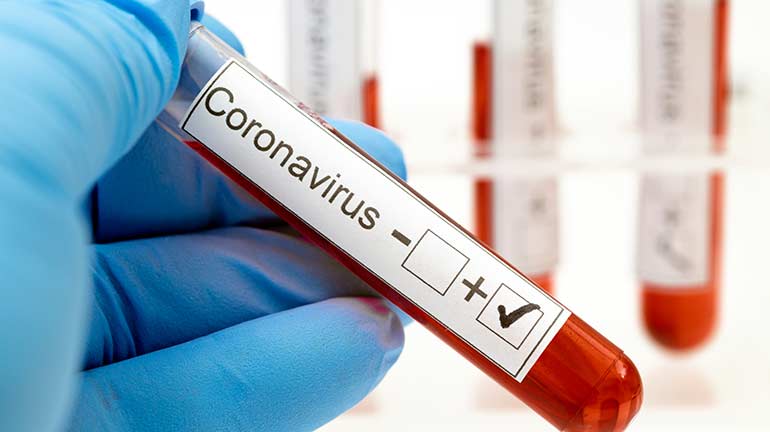 München bekommt Drive-In für Coronavirus-Test