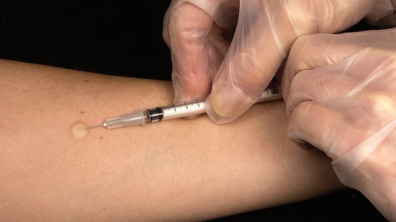 Bundestag beschließt Masern-Impfpflicht