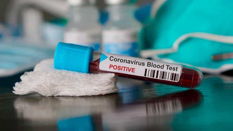 Coronavirus-Studie: Wissenschaftler starten Bluttests in München