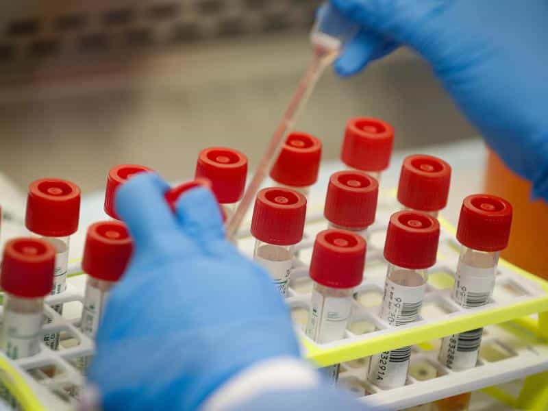 USA: Klinischer Test für Coronavirus-Impfstoff gestartet