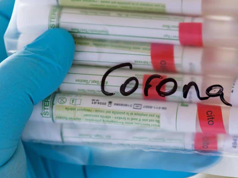 Mehr als 121.300 Corona-Nachweise in Deutschland