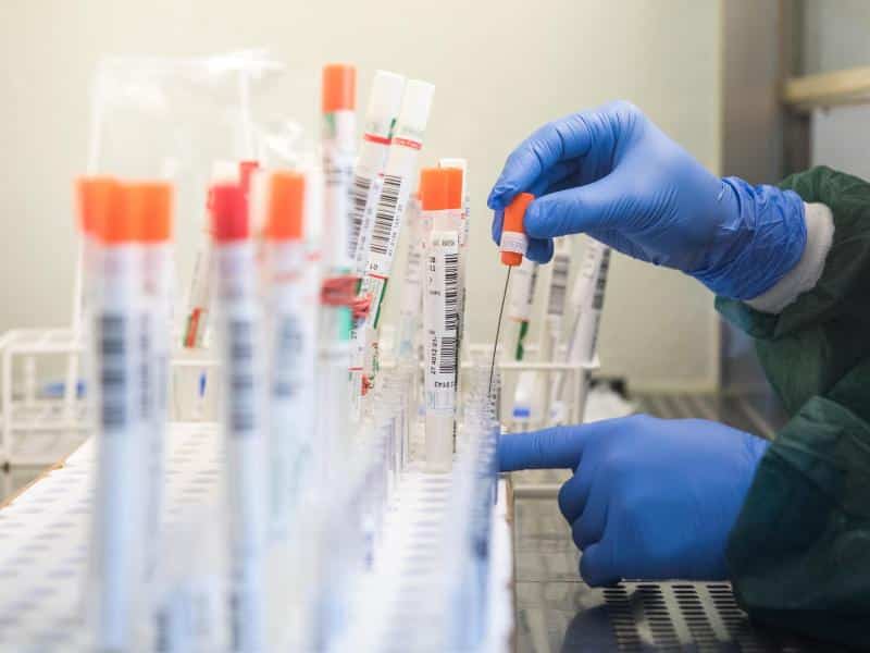 Labore warnen vor Überlastung durch immer mehr Corona-Tests
